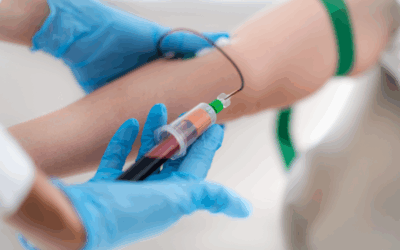 Contraindicaciones del plasma rico en plaquetas: qué enfermedades debes tener en cuenta